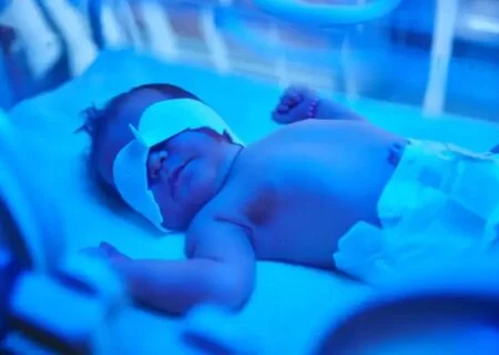 یک فوق تخصص نوزادان:
                                میانگین تولد کودکان نارس در هرمزگان بالاست/با کمبود تخت مواجه‌ایم